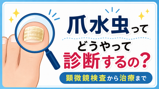 爪水虫はどうやって診断する？顕微鏡検査から治療までを解説